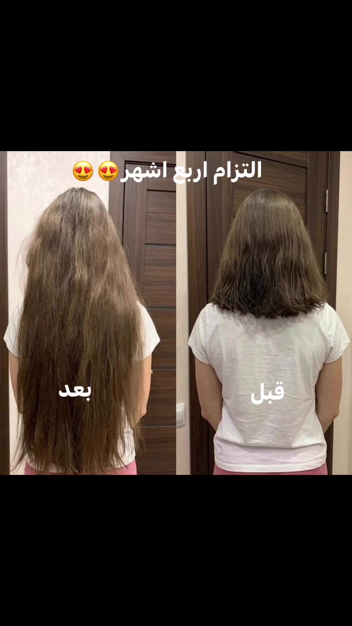 كورس علاجي مضمون للشعر


**إذا كنت صاحب هذا الإعلان وتريد حذفه لأي سبب، رجاءا أرسل رسالة إلى الدعم الفني**