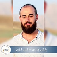 زراعة الشعر • مركز جاف • كلار