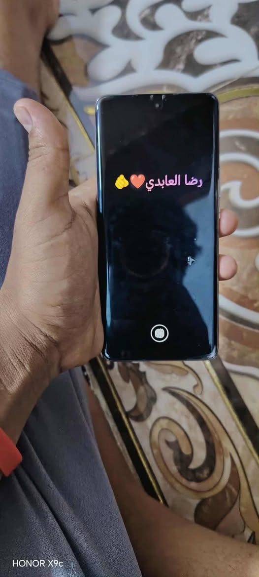 سلام عليكم جهاز هونرx9b ذاكره 256 عشوائيه 12 نضيف الجهاز بيه بس فطر بلكامرا زغير كلش سعره 275 وبيه مجال


**إذا كنت صاحب هذا الإعلان وتريد حذفه لأي سبب، رجاءا أرسل رسالة إلى الدعم الفني**