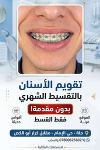 تقويم اسنان • تقسيط شهري • الحله