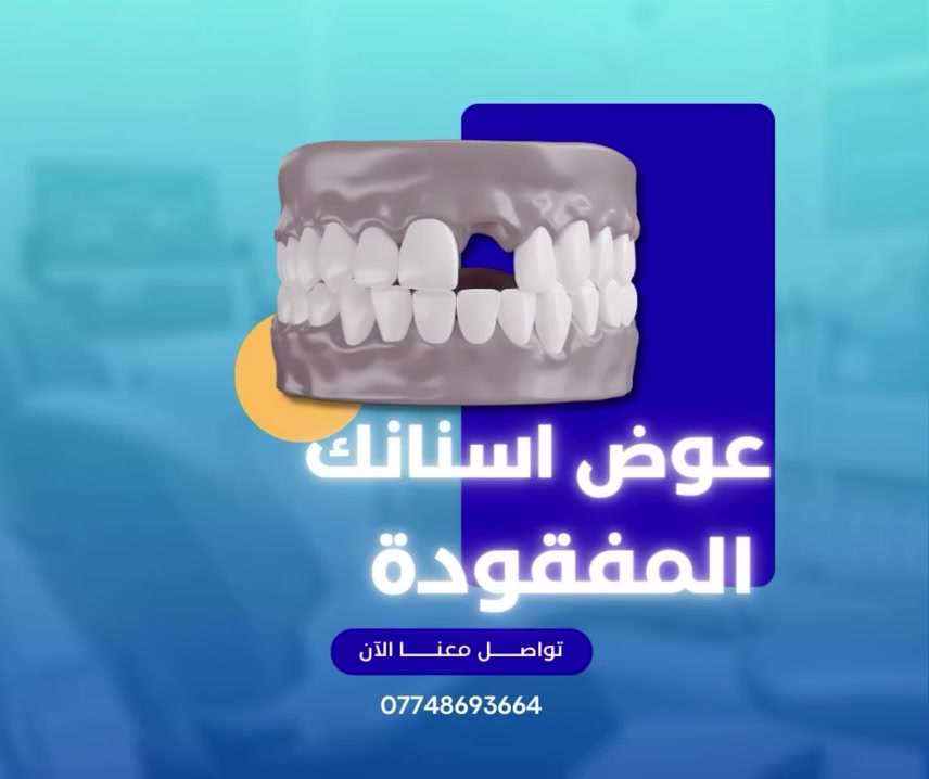 #استعادة_ابتسامتك_قبل_العيد يمنا بإنسب الأسعار 
للحجز والاستفسار ***********
