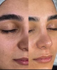 تنظيف بشرة • صالون اسوو • حي التعليم العالي