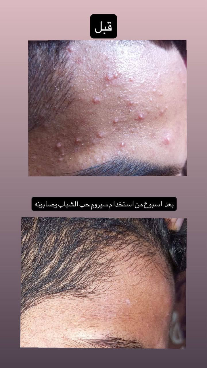بنات هدا المختبر بالعسكري مدارس مسوي عروض على كافه  تحاليل وعدهم منتجات هولنديه اصليه للبشره والشعر


**إذا كنت صاحب هذا الإعلان وتريد حذفه لأي سبب، رجاءا أرسل رسالة إلى الدعم الفني**