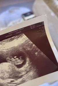 طبيبة نسائية وتوليد • معالجة العقم • مجمع الرازي ابوغريب