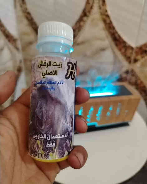 زيت الرفش ألاصلي ✨ علاج لجميع الالام وخصوصاً الانزلاق الغضروفي والام المفاصل ووجع الضهر و الفقرات العنقية ويعيد بناء المادة الغضروفية و السوفان ...
يتوفر لدى عطارية اهل بيت
بلاش بلاش بلاش 7000
قطعتين 10الف  فقط
 توصيل كل محافظات 6000
مراسله الصفحه
*********** وات ساب
