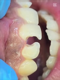 اسنان • دكتور عمر • شارع الاطباء