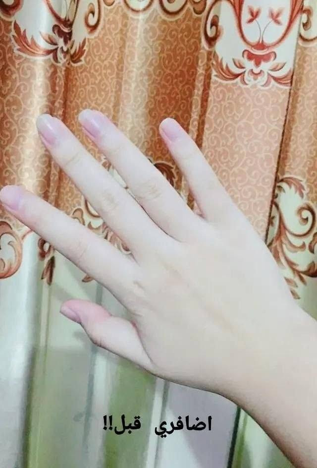 سيروم مافالا للاظافر 💅🍓
يقوي ويغذي الأظافر، يمنع التكسر والتقصف ويخليها أكثر صلابة ولمعان 🤩
لأظافر صحية وطبيعية من أول استخدام ✨
#مافالا #عناية_بالاظافر #جمالك_ببساطة
السعر عالخاص
 #مقوي_اظافر


**إذا كنت صاحب هذا الإعلان وتريد حذفه لأي سبب، رجاءا أرسل رسالة إلى الدعم الفني**