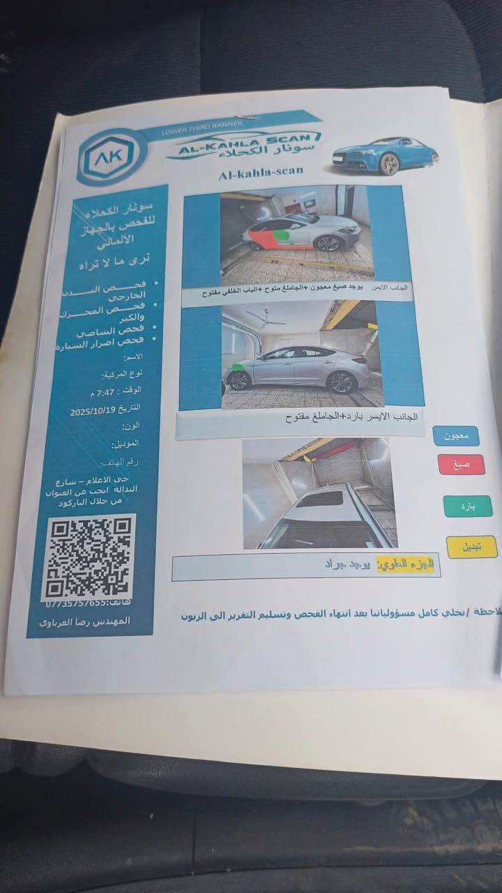 يالله 

للبيع النترا 
موديل 2017
لون فيلي 
فول موصفات 
العنوان بغداد الدورة 
***********
السعر ١١٨ وبيها مجال 
حادثها موضح بالسونار
