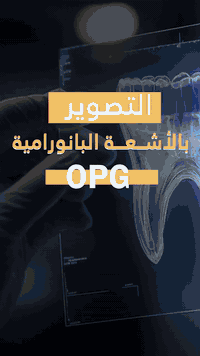أشعة بانورامية • OPG سريع • مركز بسماية