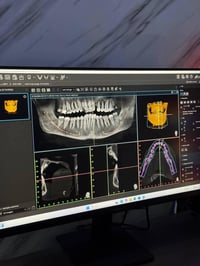 بانوراما أسنان • دقة عالية • المحمودية حي الموظفين