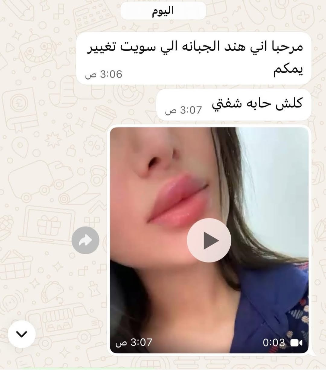 عروض مستمرة

الشهر #محرم #سنتر_تولاي مسابقه#شهر محرم 
تابع الصفه لايك مشاركه المنشور اخذ سكرين المسابقه تدخل القرعه 3فائزات 

1فلر شفه 

2ابره نضارة

3تنظيف بشرة 

المسابقه من يوم 30 لى 7/3

مجاناً مجاناً مجاناً 
فقط وصل 10

بلازما عادية 
بلازما مفعله 
بلازما +ميزو ثيرابي 

فلر شفه كوري اراستي 25
فلر رفع وجنات 50 
فلر اصدار 40
فلر تكساس 50

فلر تغير شامل كوري اراستي 100+هديه ابره نضارة 

فلر تغير شامل  فرنسي 150+
ابره نضارة 

كل هذه دلل فقط بسنتر تولاي 
عنوان بغداد الحسينية خدمات مسقط 
رقم الحجز واتساب 
***********
اشارة دفاع جوي ودفاع جوي فقط
#خاص_للنساء
#يعلن
#سنتر_تولاي
