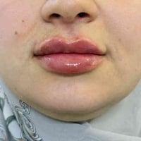 المسيب • فلر • دكتوره فيد