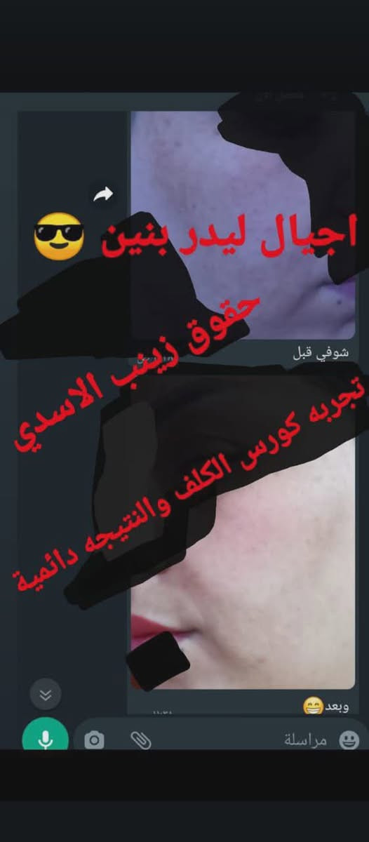 تجارب بنات منتجات شركه سيدتي الجميله


**إذا كنت صاحب هذا الإعلان وتريد حذفه لأي سبب، رجاءا أرسل رسالة إلى الدعم الفني**
