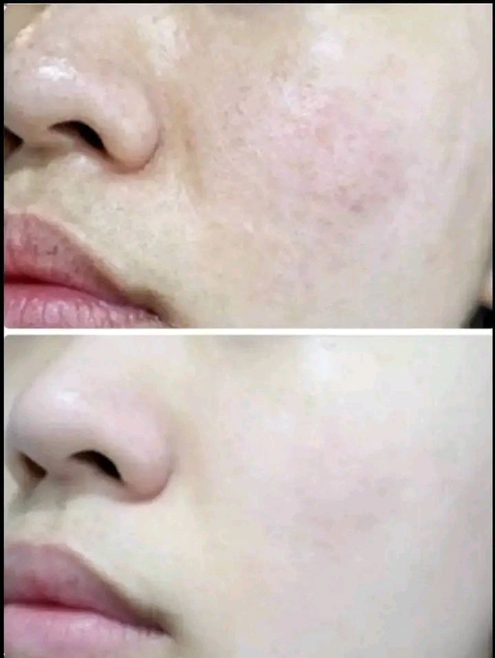 الف رحمة ع والديكم العدلين والمتوفين هذا رزقي واذا خليتولي كم ملصق مياثر عليكم بس عدي جبيرة وتكسبون وحق العباس ابو فاضل دخيل اسمه ماحلف جذب لو امووت وداعت جهالي اطيجن زيت اذا ماطول وقف الساقط وثخن شعررج وحق العباس  فلوسج تررجع زيت بل عشاب يجنن وريحته  تخبل اخمره مده سبوع يلا ابيعه ينطي مفعول اكثر 
تدعلي واني حلفت بعد
 هاي نتيجه شعري ونبي يجنننن واني من احلف حته اخلي اهل البيت كبال عيني وتغررني الفلوس وغش العالم وماكل حق غيري لو اموت وما أوكل جهالي حرام وعدي خلطه هم والله ضمان ٤ ايام تخلي الوجه گمررر للنمش كلف تصبغات كله شغل ايدي. سعر خاص بنات❤️


**إذا كنت صاحب هذا الإعلان وتريد حذفه لأي سبب، رجاءا أرسل رسالة إلى الدعم الفني**