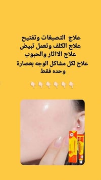 جل موفيت • تفتيح تصبغات • إيطالي