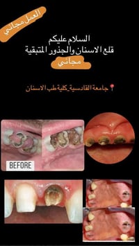 مجاني • جامعة القادسية • كلية طب الاسنان