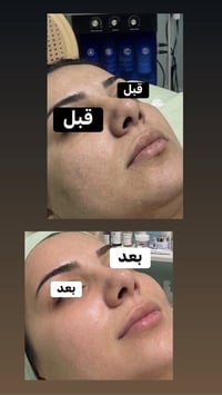مسابقة • جلسة تنضيف • آخر ٣ أيام
