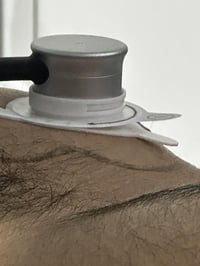 فحص الشرايين التاجية • اربيل • بغداد