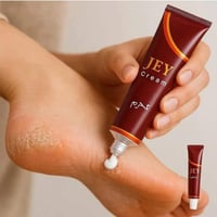 كريم كرم جي • شقوق الاقدام • شقوق اليدين