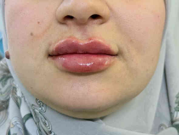 المسيب *********** الدكتوره فيد موفق ❤️‍🔥   

#فلر #فلرشفة_فلر_وجنات_فلرخطوط_ضاحكة_فلرذقن_تكساس_تكنيك❤️❤️❤️ #الشعب_الصيني_ماله_حل😂😂
