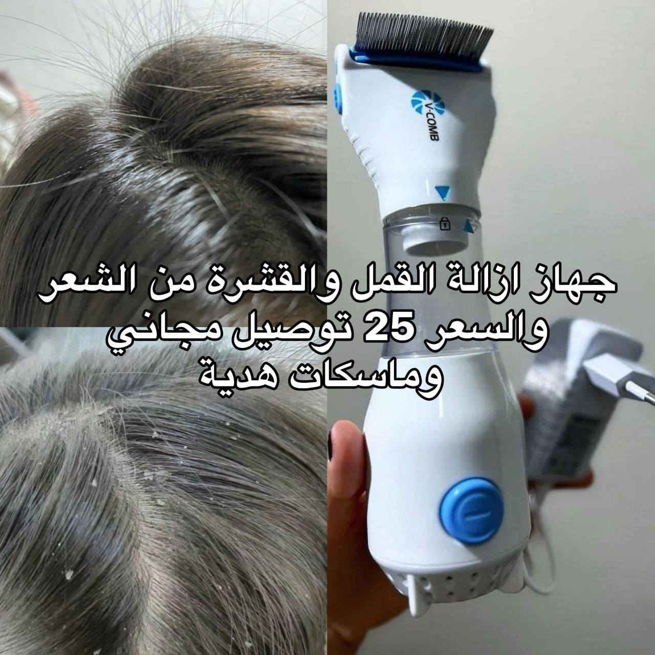 من رخصة صاحب المنشور 🙏🏻
رساله للامهات اذا اطفالج بيهم قمل 😞 لاتستحين منهم عادي القمل عدوى ماله دخل بالنظافة الشخصيـة ف اني جبتلج الحـل😁🤝 النهائي جهاز ازالة القمل هذا الاختراع انقاذ حرفيا يسحب القمل والصئبان والقشره هم ينظف من الفروه لطرف الشعره بسبب المشط مالته الي مصنوع من الفولاذ الصلب غير قابل للصدأ استخدمي ونامي وانتي مرتاحـة 😎😎


**إذا كنت صاحب هذا الإعلان وتريد حذفه لأي سبب، رجاءا أرسل رسالة إلى الدعم الفني**