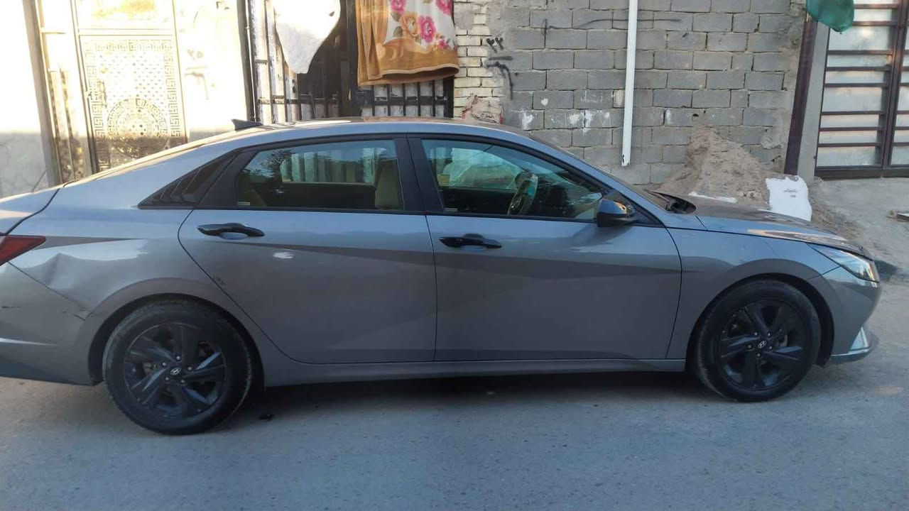 ‎النترا 21 امريكي بصمة كامرة رادارات

360 وباقي المواصفات المعروفة مكينة



2000 مكينة وكير صدر خير م‎ القائم, الأنبار


**إذا كنت صاحب هذا الإعلان وتريد حذفه لأي سبب، رجاءا أرسل رسالة إلى الدعم الفني**