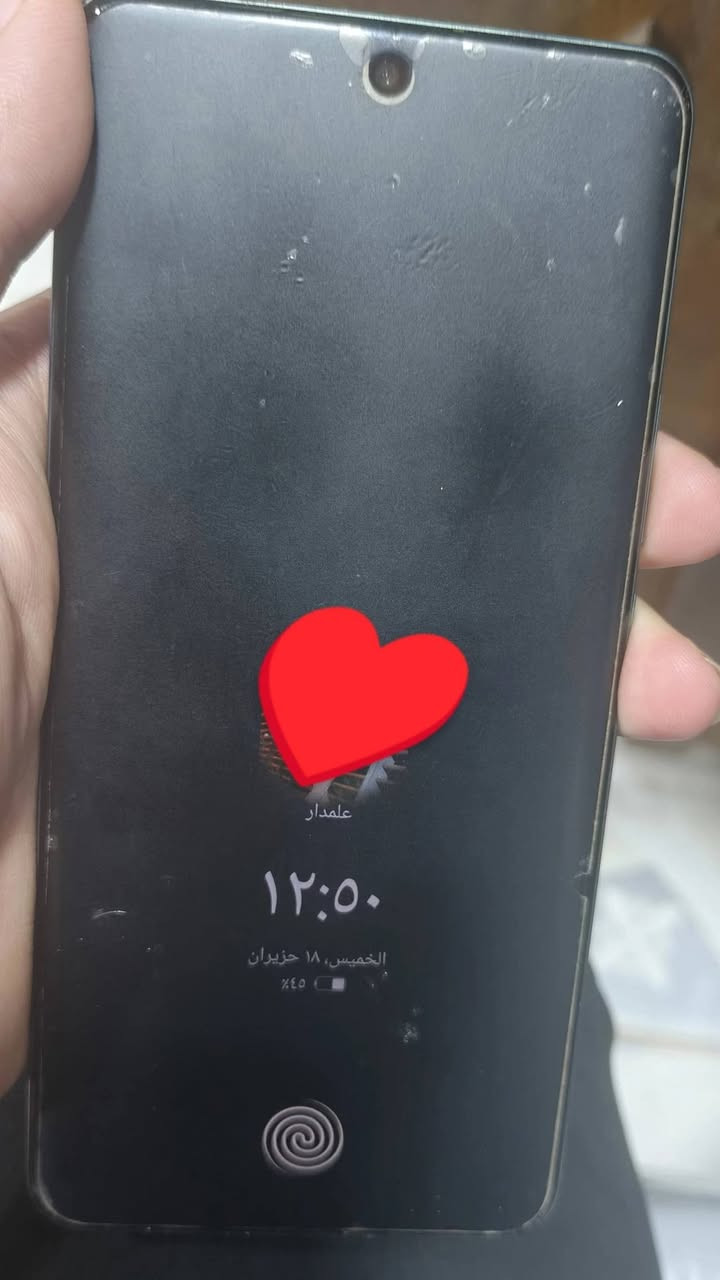 ريلمي 15 برو للبيع هاي الخدوش كلها مال لزكة واصلا اني مخليلو دبل لزكة يعني شخط مابي نضافة الجهاز 100%100 شرط خدش واحد مابي الجهاز معروف السعر 550 وبي مجال لان مستعجل على بيعتو


**إذا كنت صاحب هذا الإعلان وتريد حذفه لأي سبب، رجاءا أرسل رسالة إلى الدعم الفني**