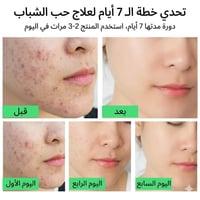 كريم ساليسيليك • تنظيف المسام • بشرة دهنية