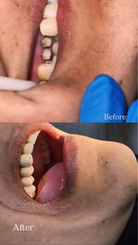 عيادة أسنان • زركون • ام العظام