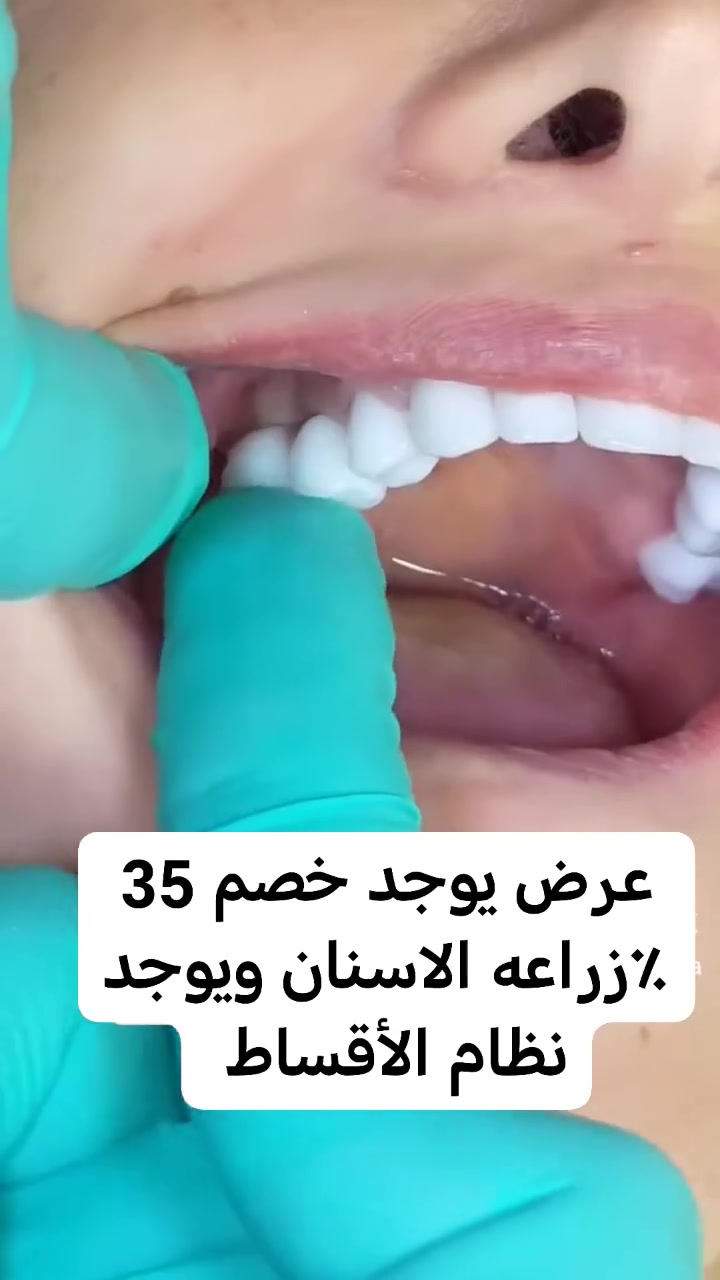 ✨ زراعة الأسنان ✨
يمّه لا تحتار .. احنا نوفرلك أرخص الأسعار مع أعلى جودة وخدمة مميزة 🌟

✅ استشارة مجانية
✅ أسعار تناسب الجميع
✅ أقساط مريحة

📍 للحجز والاستفسار: [الاتصال على الرقم *********** واتساب*********** ]

المحموديه
