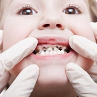 علاج اسنان مجاني • تنظيف وحشوات • جامعة الفراهيدي