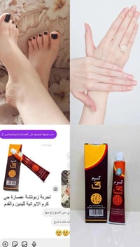 كريم كرم جي • أصلي إيراني • تشققات اليدين