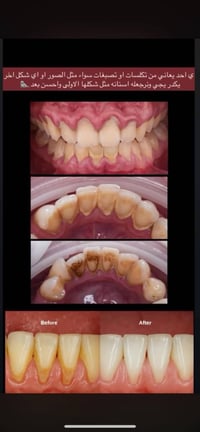 عيادات كلية الحلة • شارع الأربعين • علاج مجاني