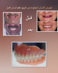 طقم أسنان كامل • علاج مجاني • كربلاء الحر الصغير