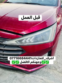 بعقوبة الجديدة • النترا • تركيب عدسات