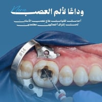 وداعًا لألم العصب… ✨ مع علاج حشوة العصب نخلّصك من الألم ونحافظ على سنّ...