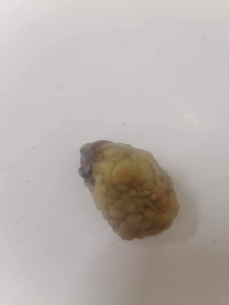 الزوعه المعطفه العجيبه سعره بس 25الي يريده يجي واتساب  ***********
