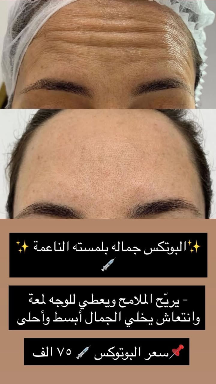 عروض عيد الاضحي المبارك 
للحجز والاستفسار مراسلة صفحة


**إذا كنت صاحب هذا الإعلان وتريد حذفه لأي سبب، رجاءا أرسل رسالة إلى الدعم الفني**