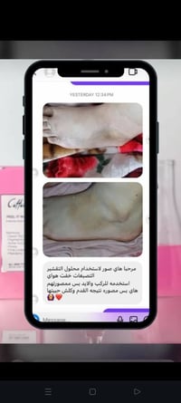 بنات متوفره لدينا مادة تقشير كاربوني  توفرررت لدينا للحجز والاستسفسار ...