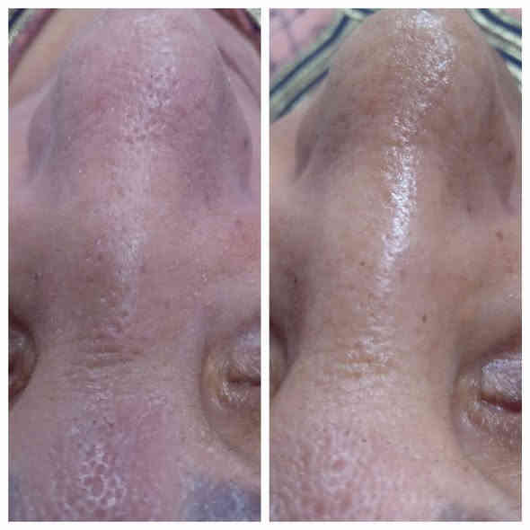 صالون فوفو بيوتي للتجميل
عـروض

عرائس: ميكب وتسريحة ورموش وعدسات وبدلة عرس بـ 150 ألف.

الطالبات: تنظيف VIP ورموش دائمة وبدلتها مفعّلة بـ 100 ألف.

عرض أكريلك: أكستنشن مع تقشير وتنظيف اليد والقدم بـ 35 ألف.

تنظيف بشرة VIP مع إبره الليمونتال مع بدلتها مفعّلة بـ 65 ألف.

صبغ شعر قصير وتحصيل مع معالج تريتمنت بـ 35 ألف.

صبغ شعر متوسط وتحصيل مع معالج تريتمنت بـ 50 ألف.

صبغ شعر طويل وتحصيل مع معالج تريتمنت بـ 65 ألف.

للخريجات: رموش وميكب وتسريحة وأكريلك بـ 65 ألف، وكل طالبتين الثالثة مجاناً.

الموقع: زيونة – تقاطع ميسلون
للاتصال:
***********
***********
