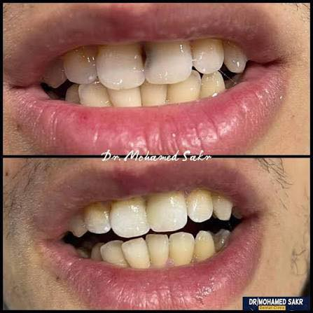 مرحبا إذا اكو شخص عنده هيج تسوس   وحاب يسوي يتواصل وياي العمل مجاني *********** جامعه المستقبل/طريق حله نجف
