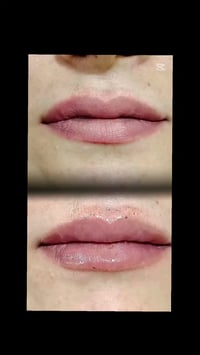 تجميل شفايف • تجميل وجه • بعقوبة-التحرير