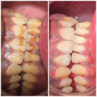 عيادة اصلان • يومياً ٤عصراً • أسنان وتجميل