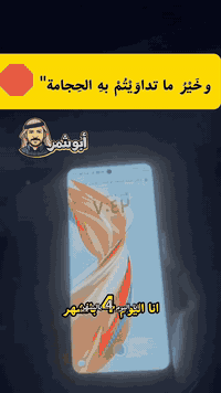 حجامة نبوية • أدوات معقمة • الموصل تل عبطة