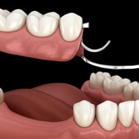 علاج اسنان مجاني • اسنان صناعية • موصل شلالات