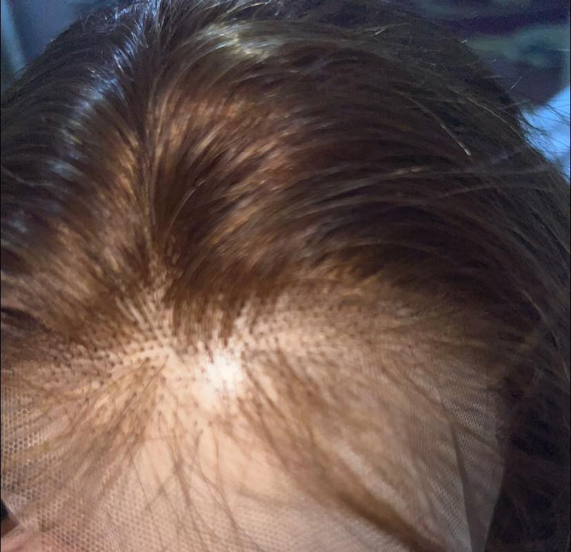 باروكة شعر طبيعي فل شبكة تنفرك كل الاتجاهات تنصبغ تنقصر تتشسور ضمان مدى الحياة


**إذا كنت صاحب هذا الإعلان وتريد حذفه لأي سبب، رجاءا أرسل رسالة إلى الدعم الفني**