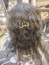 يغذي الشعر • يوقف التساقط • ضمان ٥سنوات