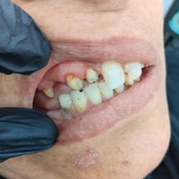 د. منذر حبيب • قسم الأسنان • الناصرية