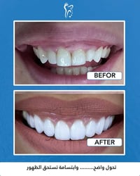 تقويم أسنان • تبييض أسنان • زراعة أسنان