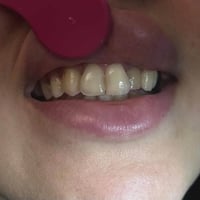 مركز ماسة • طب وجراحة الفم والأسنان • الحسينية بغداد